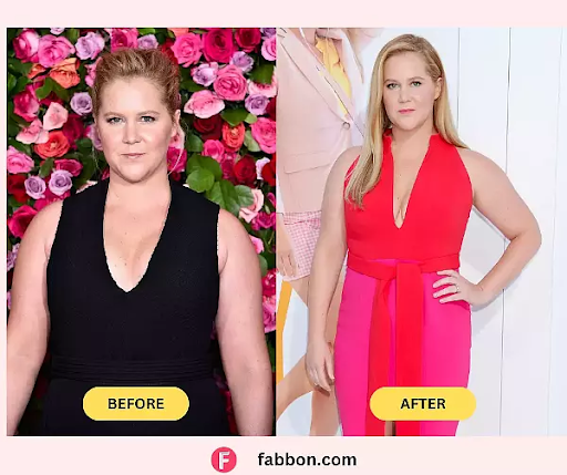 Inside Amy Schumer’s Honest Weight Loss Transformation